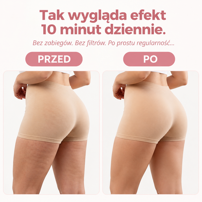 Solessa - masażer modelujący sylwetkę